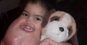 A 3 éves kislány olyan műtéten esett át, amely megváltoztatta az életét. Egészen ártalmatlanul kezdődött a gyötrelme