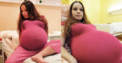 A 23 éves cseh nő azt hitte, hogy ikrekkel terhes. Elsírta magát, amikor meglátta az ultrahangos felvételeit