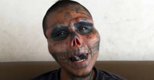 A 22 éves férfi levágta az orrát és a füleit, hogy koponyára hasonlítson. Felismerhetetlen a beavatkozás előtti fotókon