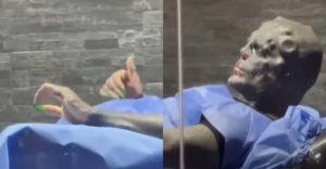 VIDEÓ: Földönkívülinek akart kinézni, ezért levágatta két egészséges ujját