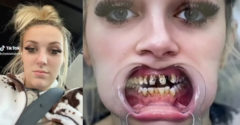 Egy nőt mindig kigúnyoltak a fogai miatt. Amikor megjelent az új fogsorával, szóhoz sem jutottak a gúnyolói.