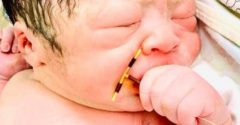 Az újszülöttről készült fotó bejárta az internetet. Mindezt azért, amit közvetlenül a születése után a kezében tartott