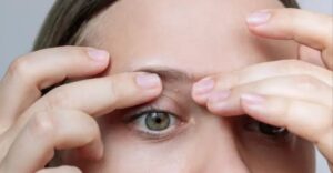 Figyelmeztetés azoknak, akiknek apró fehér pontok jelennek meg a testükön: Az orvos elmagyarázza, hogyan lehet őket biztonságosan eltávolítani