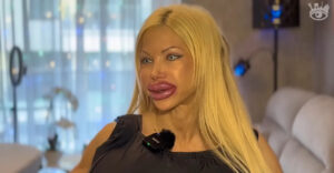 Az ország legnagyobb mellű nője, Baj Angelika Brüsszelbe repül, mert Magyarországon már nem vállalják az újabb műtétet